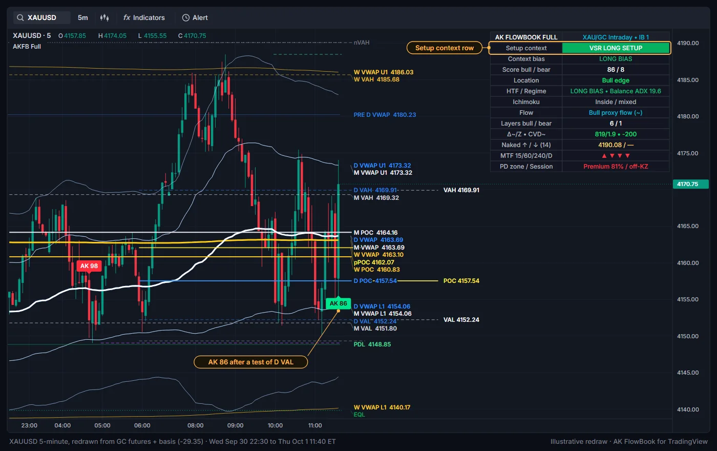 An AK score label below a bar at the day's value area low, with the dashboard row Setup context